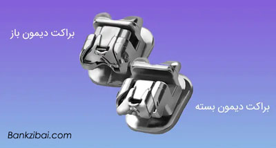 ارتودنسی